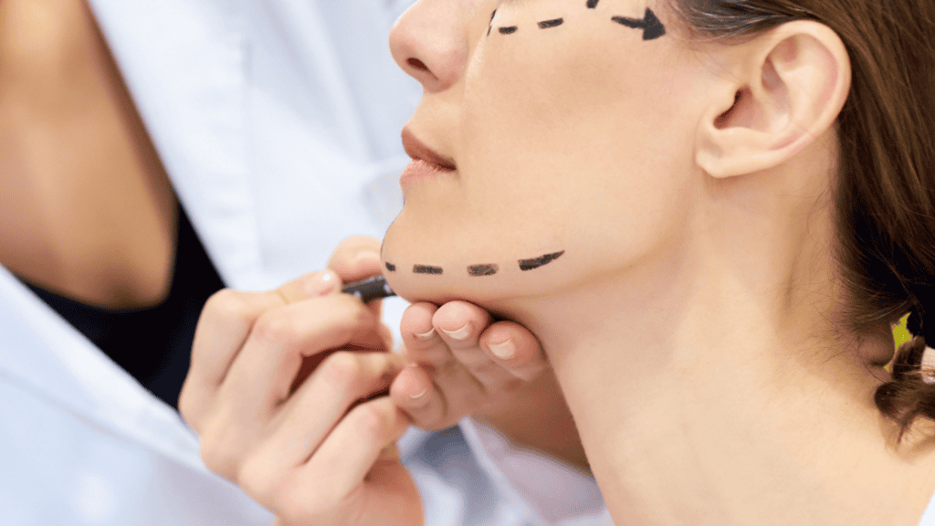 ultherapy